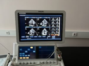 Ultraschall Herz-Diagnosegerät Modell 1